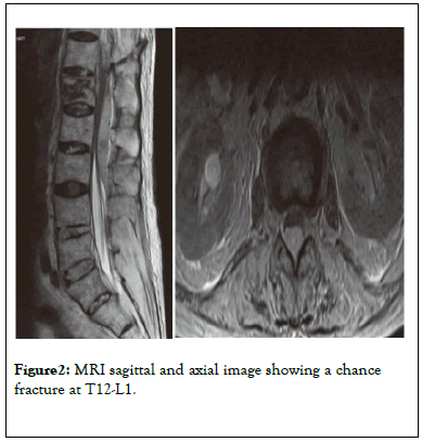 muscular-system-sagittal