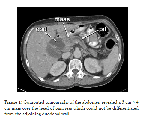 pancreatic-disorders-head