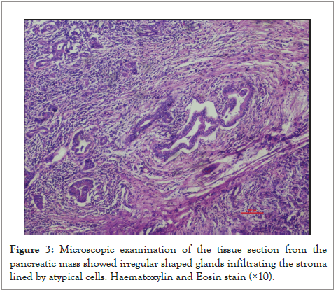 pancreatic-disorders-tissue