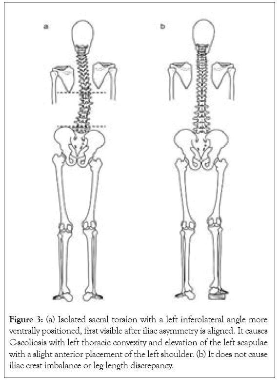 physical-medicine-torsion