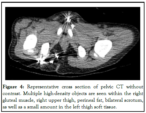 CPOA-CT