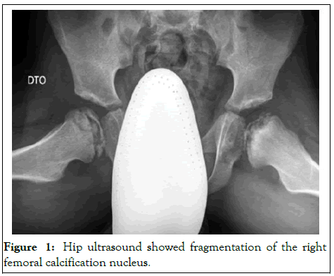 CPOA-Hip
