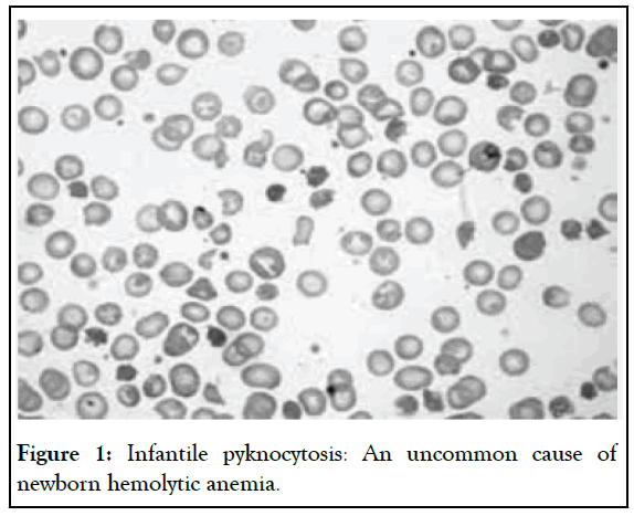 pyknocytosis