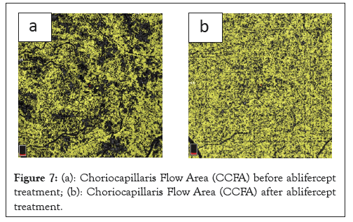 Choriocapillaris