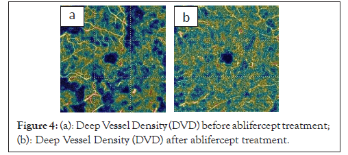 Density