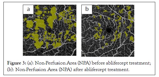 Perfusion