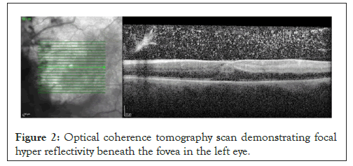 tomography