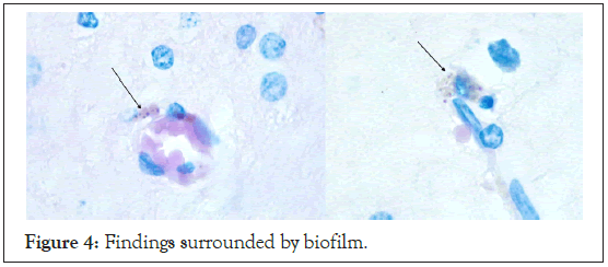 biofilm