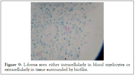 intracellularly