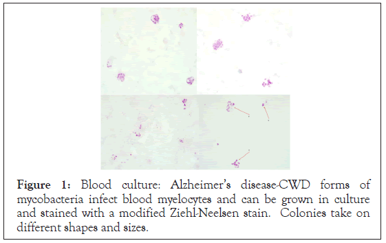 mycobacteria