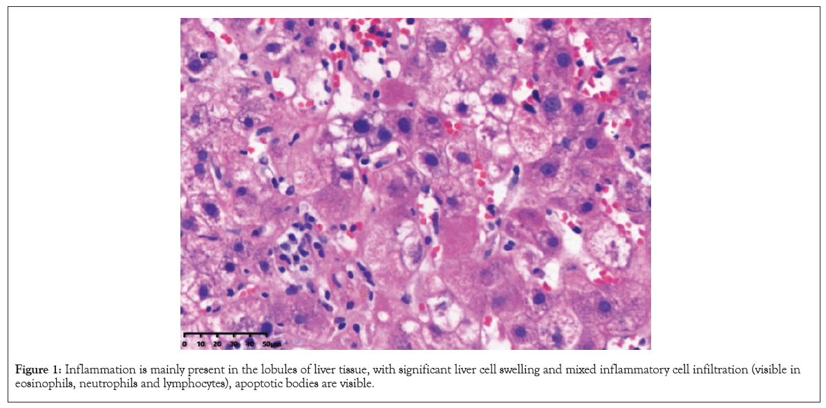 Inflammation