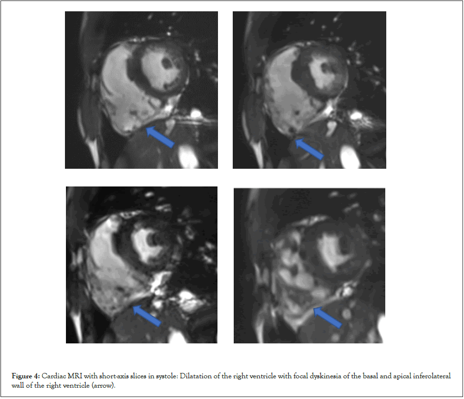 clinical-experimental-cardiology-dyskinesia