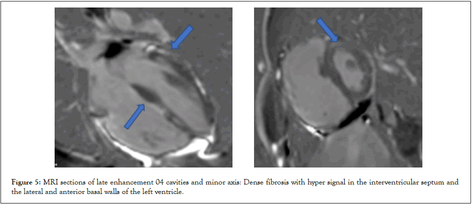 clinical-experimental-fibrosis