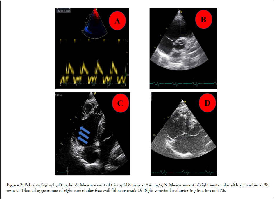 clinical-experimental-cardiology-ventricular