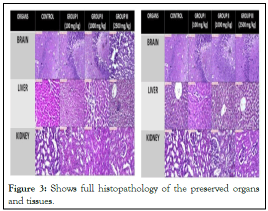 histopathology