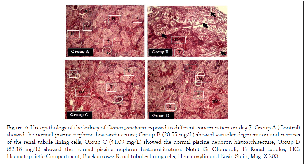 kidney