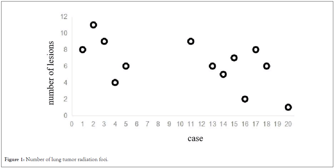 clinical-trials-lung