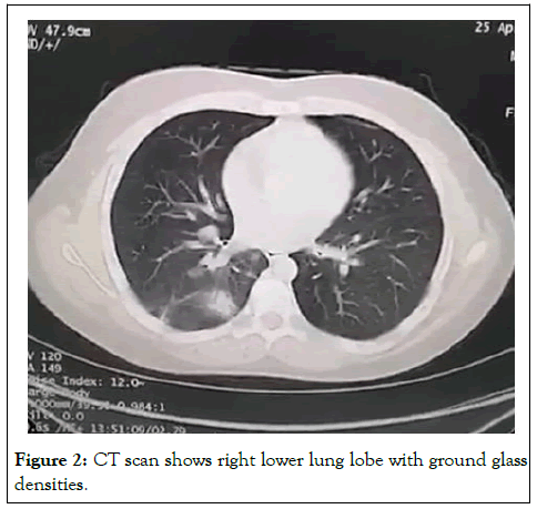 cpoa-CT