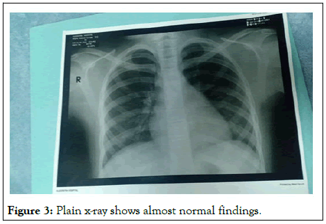 cpoa-normal
