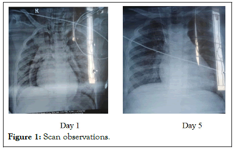 jacr-Scan