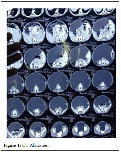 ptcr-CT