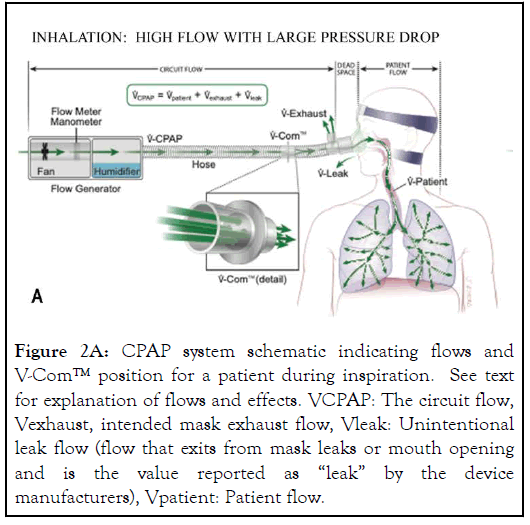 CPAP