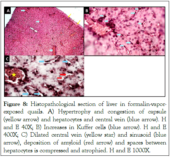 liver