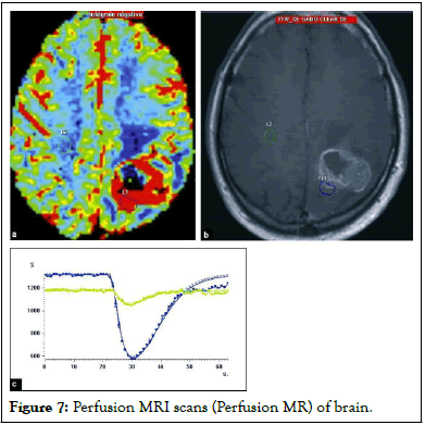 JTDR-Perfusion