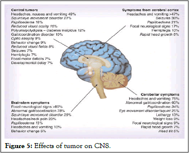 JTDR-tumor
