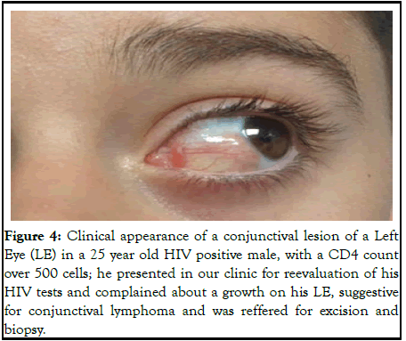 jceo-cellulitis