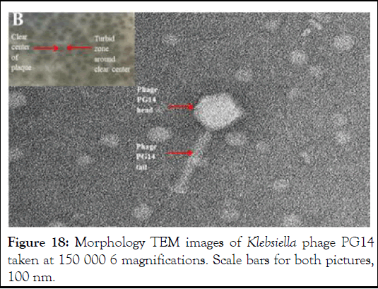 jcma-phage