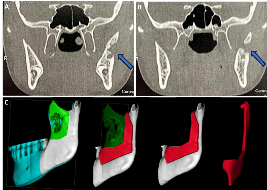 mrcs-3d