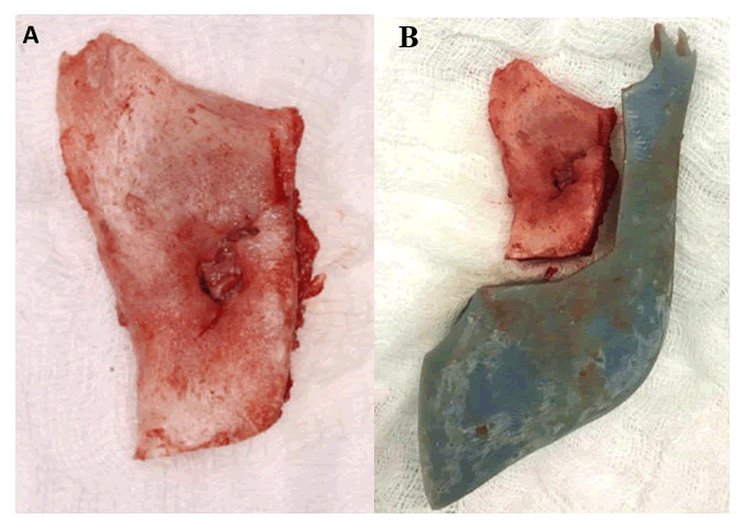 mrcs-3d