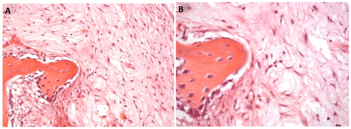 mrcs-3d