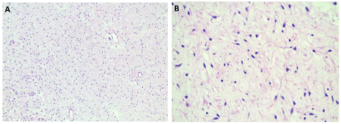 mrcs-3d
