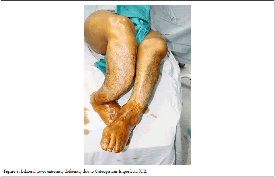 physical-medicine-rehabilitation-lower