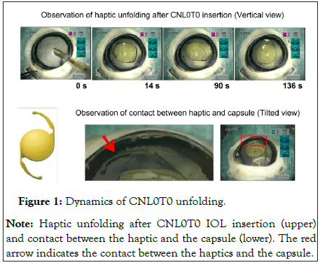 ophthalmology