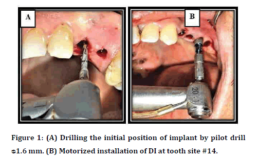 Dental-Science-Drilling-initial