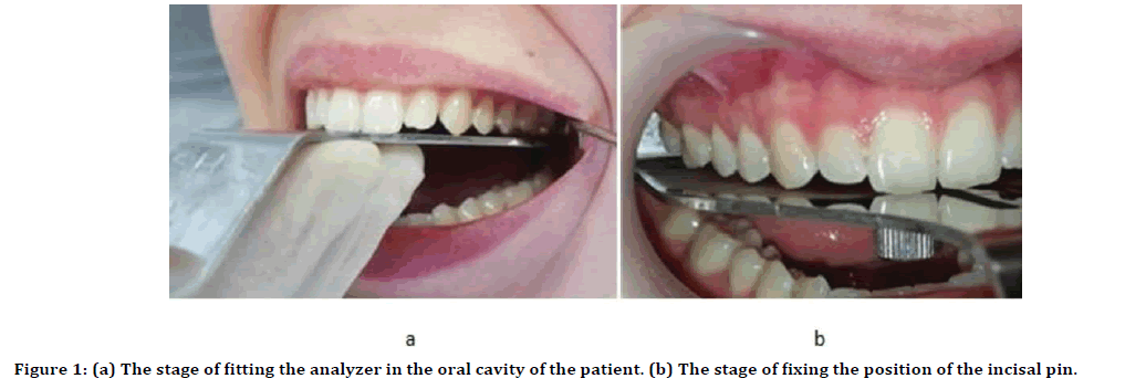 Dental-Science-fitting