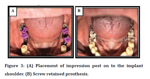 Dental-Science-impression-post