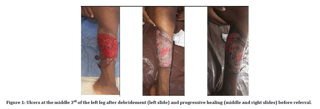 Dental-Science-left-leg-7-5-67-g001 Dental-Science-left-leg-7-5-67-g001