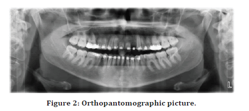 Medical-Dental-Orthopantomographic-picture