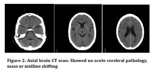 Medical-Dental-Science-cerebral-pathology