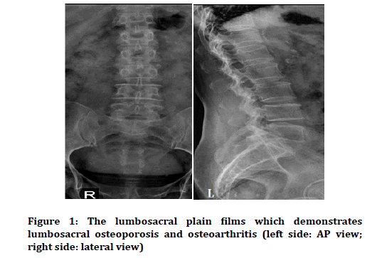 Medical-Dental-Science-lumbosacral