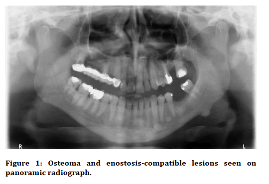 Medical-Dental-enostosis-compatible