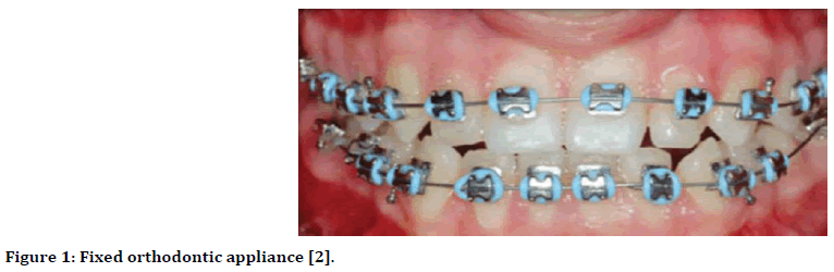 Medical-Dental-orthodontic-appliance