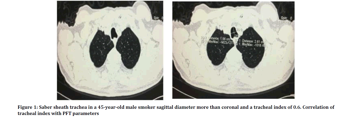 Medical-Dental-smoker-sagittal