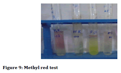 Medical-dental-Methyl-red-test