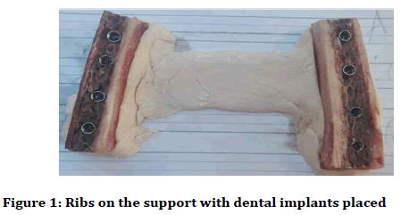 Medical-dental-implants