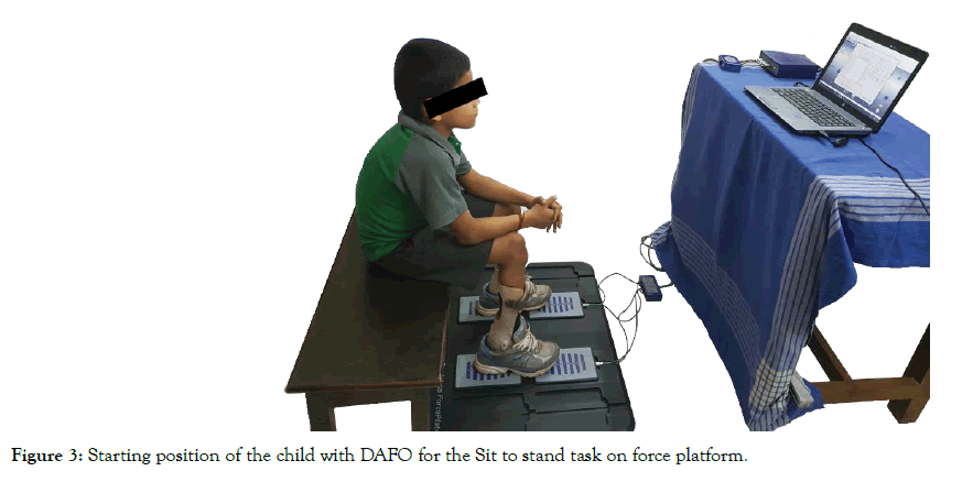 Physical-Therapy-force-platform